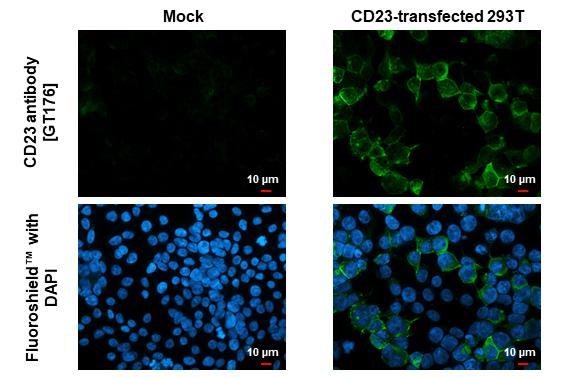 CD23 Antibody in Immunocytochemistry (ICC/IF)