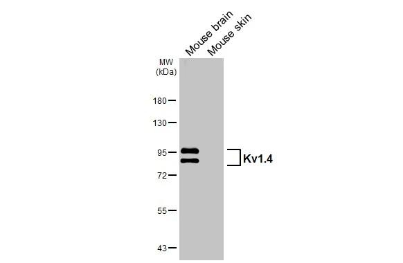 KV1.4 (KCNA4) Antibody in Western Blot (WB)