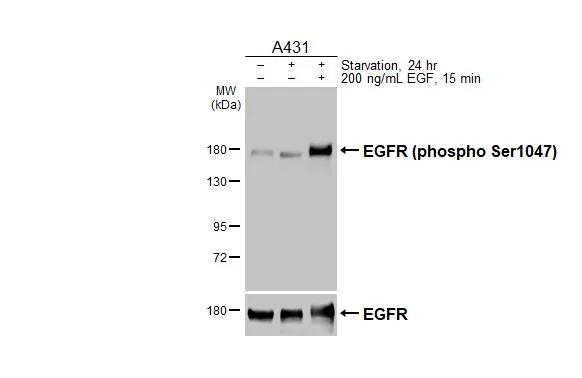 Phospho-EGFR (Ser1047) Antibody in Western Blot (WB)