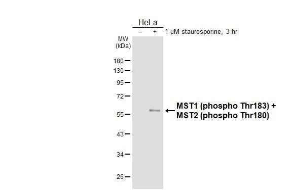 Phospho-MST1/MST2 (Thr183, Thr180) Antibody in Western Blot (WB)