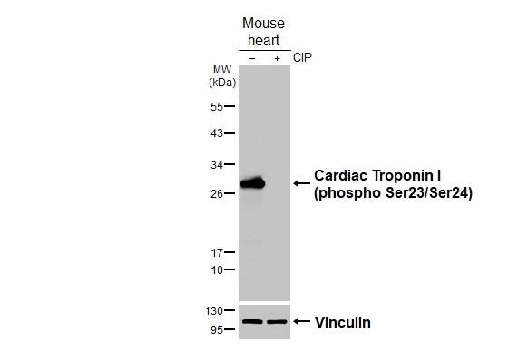 Phospho-Cardiac Troponin I (Ser23, Ser24) Antibody in Western Blot (WB)