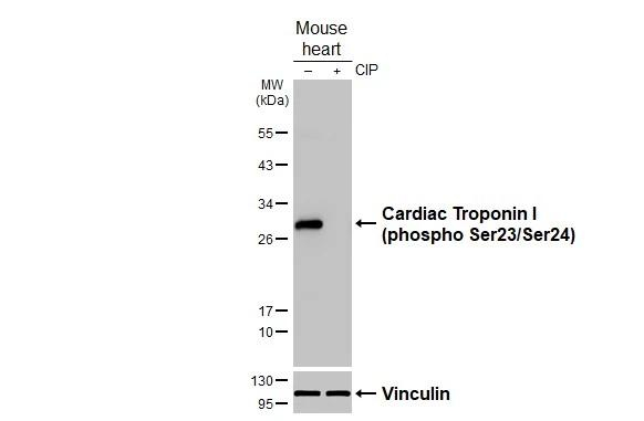 Phospho-Cardiac Troponin I (Ser23, Ser24) Antibody in Western Blot (WB)