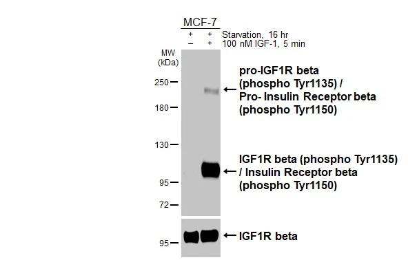 Phospho-IGF1R beta (Tyr1135, Tyr1150) Antibody in Western Blot (WB)