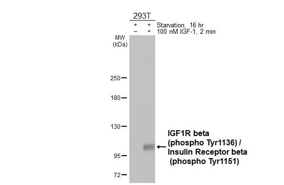 Phospho-IGF1R beta (Tyr1316) Antibody in Western Blot (WB)