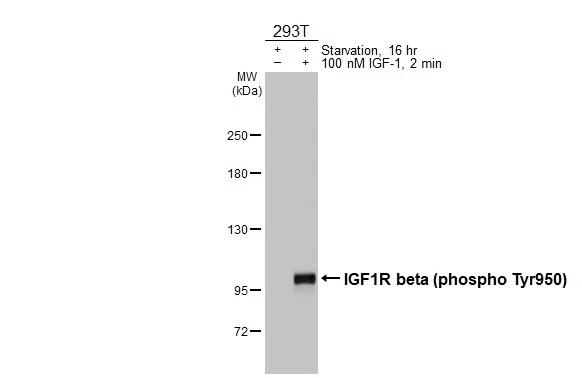 Phospho-IGF1R beta (Tyr950) Antibody in Western Blot (WB)