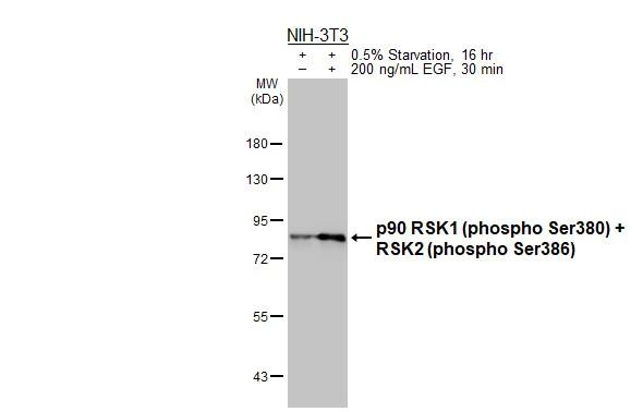 Phospho-RSK1/RSK2 (Ser380, Ser386) Antibody in Western Blot (WB)