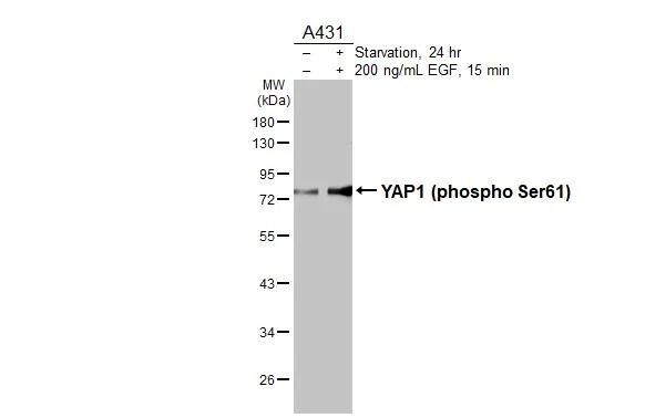 Phospho-YAP1 (Ser61) Antibody in Western Blot (WB)