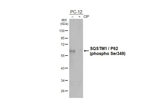 Phospho-SQSTM1 (Ser349) Antibody in Western Blot (WB)
