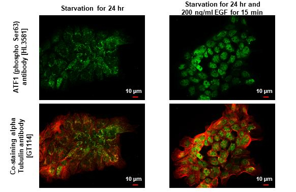 Phospho-ATF1 (Ser63) Antibody in Immunocytochemistry (ICC/IF)