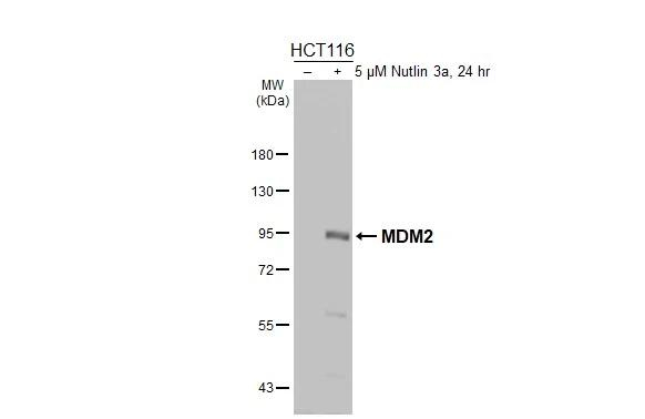 MDM2 Antibody in Western Blot (WB)