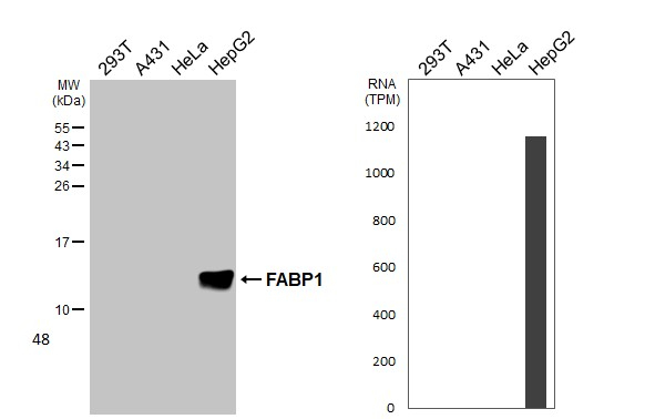 FABP1 Antibody in Western Blot (WB)