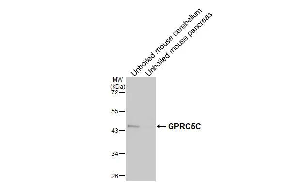 GPRC5C Antibody in Western Blot (WB)