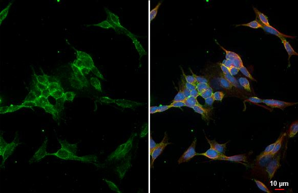CD56 Antibody in Immunocytochemistry (ICC/IF)