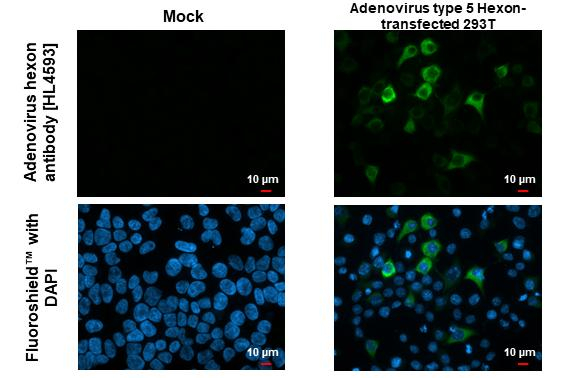 Adenovirus Hexon Antibody in Immunocytochemistry (ICC/IF)