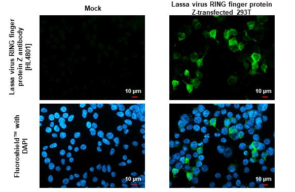 Lassa virus RING finger protein Z Antibody in Immunocytochemistry (ICC/IF)