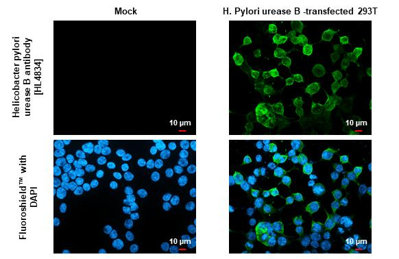 Helicobacter pylori Urease B Antibody in Immunocytochemistry (ICC/IF)