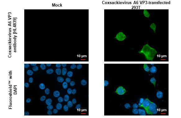 Coxsackievirus A6 VP3 Antibody in Immunocytochemistry (ICC/IF)