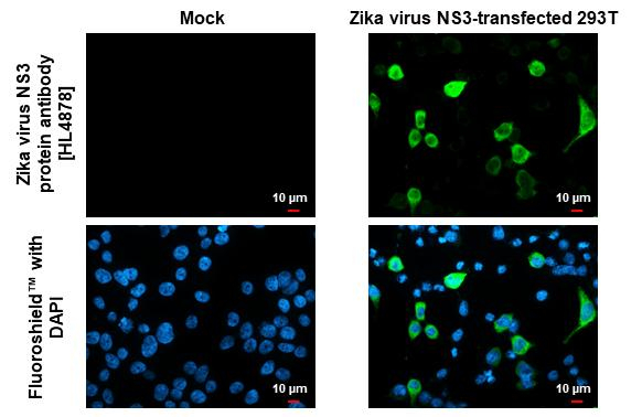 Zika Virus NS3 Antibody in Immunocytochemistry (ICC/IF)