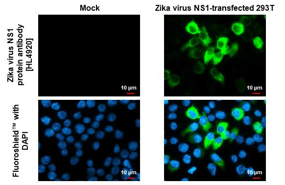Zika Virus NS1 Antibody in Immunocytochemistry (ICC/IF)