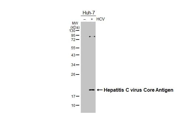Hepatitis C Virus Core Antigen Antibody in Western Blot (WB)