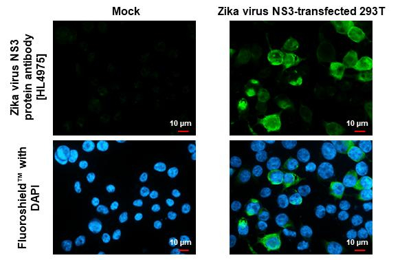 Zika Virus NS3 Antibody in Immunocytochemistry (ICC/IF)