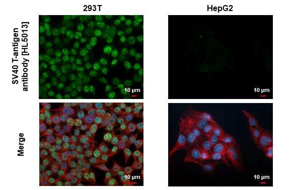 SV40 T-Antigen Antibody in Immunocytochemistry (ICC/IF)