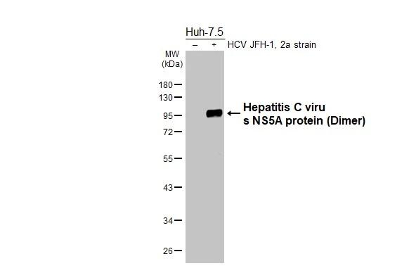Hepatitis C Virus NS5a Antibody in Western Blot (WB)