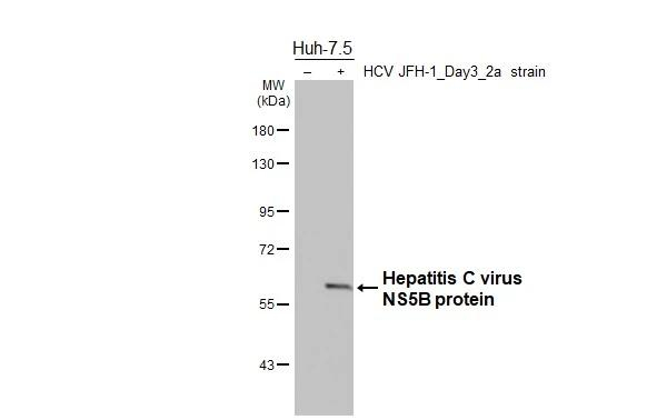 Hepatitis C Virus NS5b Antibody in Western Blot (WB)