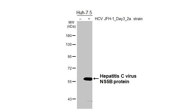 Hepatitis C Virus NS5b Antibody in Western Blot (WB)