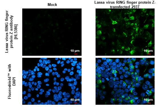 Lassa virus RING finger protein Z Antibody in Immunocytochemistry (ICC/IF)