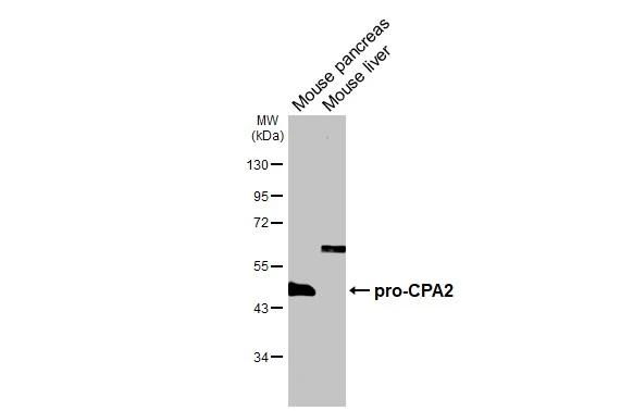 Carboxypeptidase A2 Antibody in Western Blot (WB)