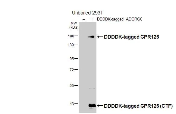 GPR126 Antibody in Western Blot (WB)