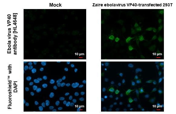 Ebola Virus VP40 Antibody in Immunocytochemistry (ICC/IF)