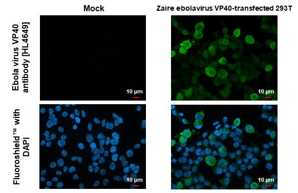 Ebola Virus VP40 Antibody in Immunocytochemistry (ICC/IF)