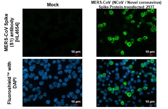 MERS Coronavirus Spike Protein S1 Antibody in Immunocytochemistry (ICC/IF)