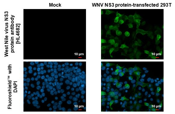 West Nile Virus NS3 Protein Antibody in Immunocytochemistry (ICC/IF)