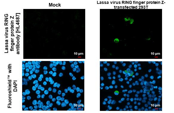Lassa virus RING finger protein Z Antibody in Immunocytochemistry (ICC/IF)