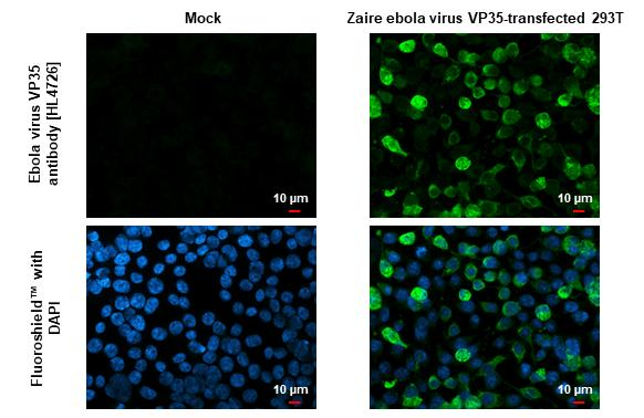 Ebola Virus VP35 Antibody in Immunocytochemistry (ICC/IF)