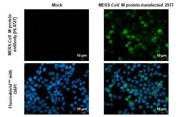 MERS Coronavirus M Antibody in Immunocytochemistry (ICC/IF)