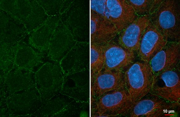 Desmocollin 2 Antibody in Immunocytochemistry (ICC/IF)