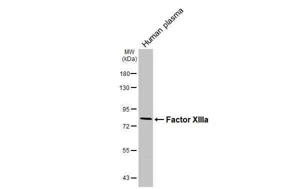 Factor XIII A Antibody in Western Blot (WB)