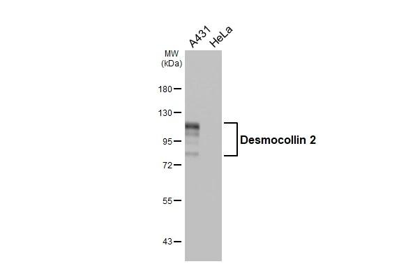 Desmocollin 2 Antibody in Western Blot (WB)