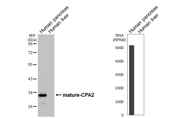 Carboxypeptidase A2 Antibody in Western Blot (WB)
