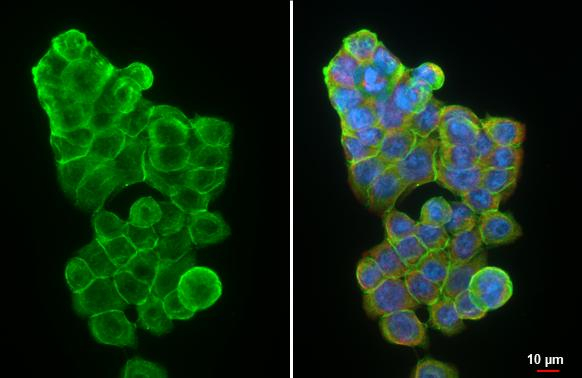 LRRK1 Antibody in Immunocytochemistry (ICC/IF)