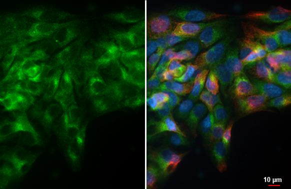 ARL5A Antibody in Immunocytochemistry (ICC/IF)