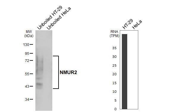NMUR2 Antibody in Western Blot (WB)