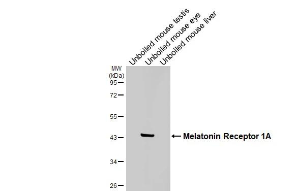 MTNR1A Antibody in Western Blot (WB)