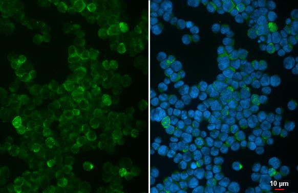 RAB9B Antibody in Immunocytochemistry (ICC/IF)