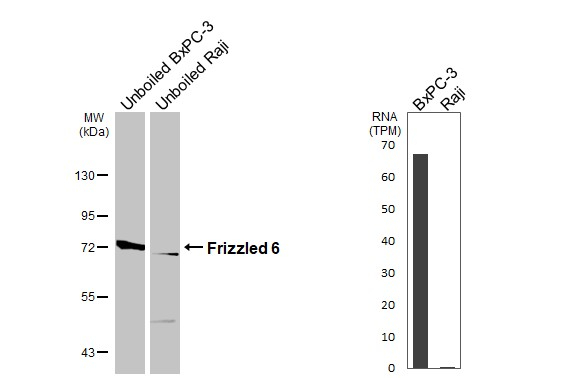 FZD6 Antibody in Western Blot (WB)