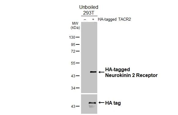 TACR2 Antibody in Western Blot (WB)